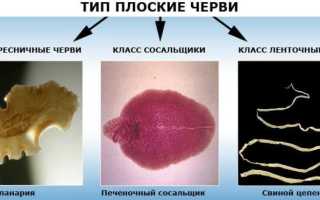 Тип Плоские черви – общая характеристика, внутренне и внешнее строение, системы органов и значение в природе