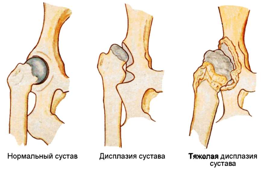 схема дисплазия суставов у собак