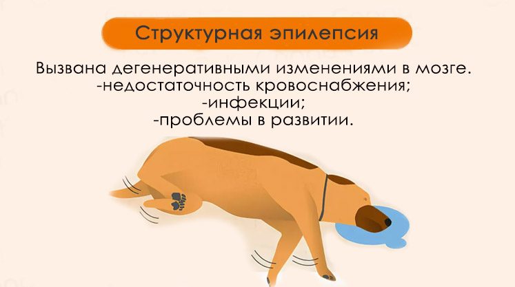 симптоматическая эпилепсия
