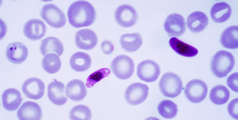 P. Falciparum в микроскопе