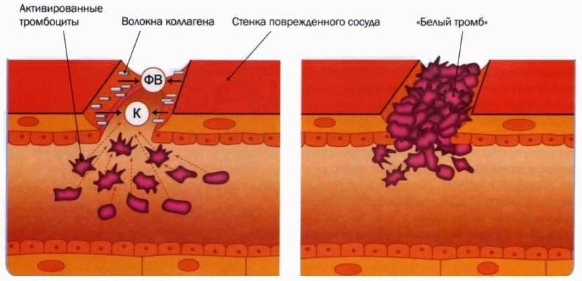Механизм образования первичного тромба